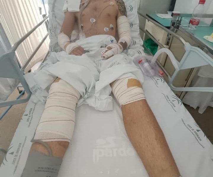 El motorista accidentad e ingresado en el hospital.