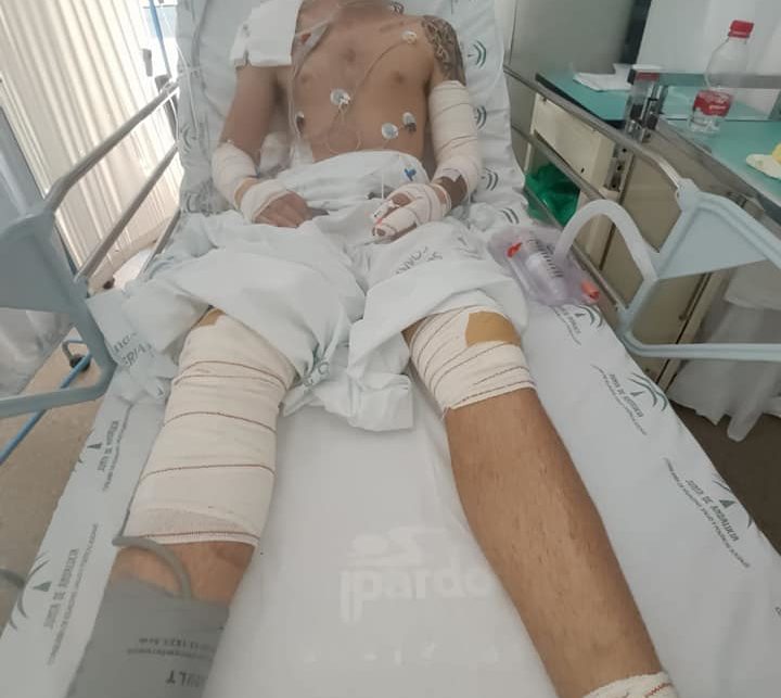 El motorista accidentad e ingresado en el hospital.