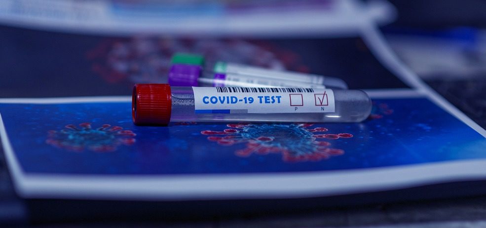 Muestra de una prueba vírica de la Covid-19.