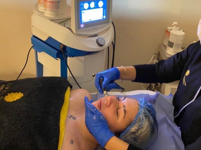 Tratamiento facial en Clínica Infantes, ubicada en la Avenida Salamanca de Bormujos.
